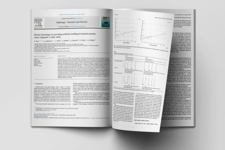Clinical advantages in providing artificial intelligence-assisted prostate cancer diagnosis: an innovative pilot study by Ipatimup