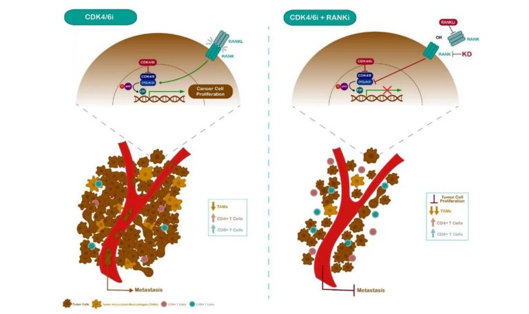 Inibição da via RANK sensibiliza o cancro da mama triplo negativo a inibidores de CDK4/6 e potencia a resposta imunitária
