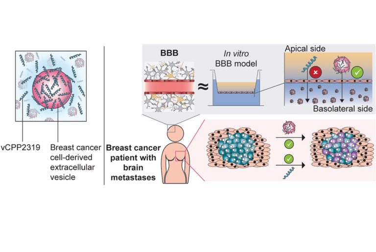 O vCPP2319 interage com as vesículas extracelulares do cancro da mama metastático