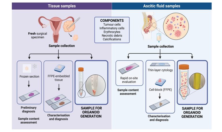 From operating room to laboratory: a pathologist’s perspective on tubo-ovarian patient-derived organoids