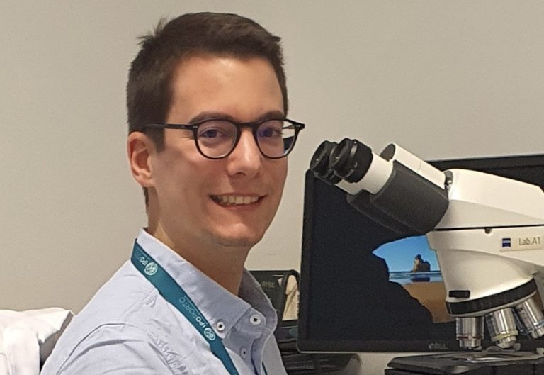 Médicos Patologistas evidenciam “armadilha” no diagnóstico de cancro da próstata