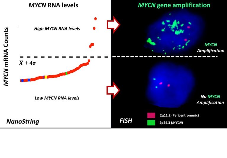 Uma nova forma de prever a presença de amplificação genética de MYCN em tumores cerebrais pediátricos pela análise de moléculas de RNA