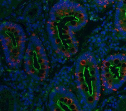 Study reveals that the mitotic spindle positioning (MISP) protein is overexpressed in intestinal metaplasia and gastric cancer