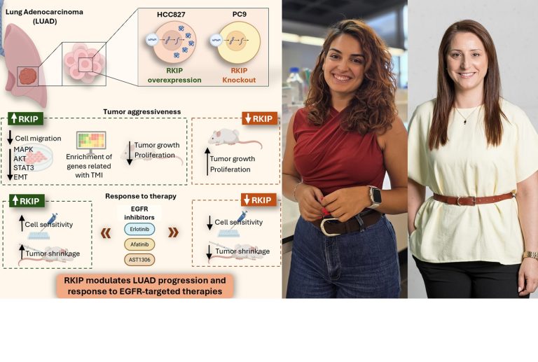 Estudo revela potencial do RKIP para reduzir agressividade do adenocarcinoma pulmonar