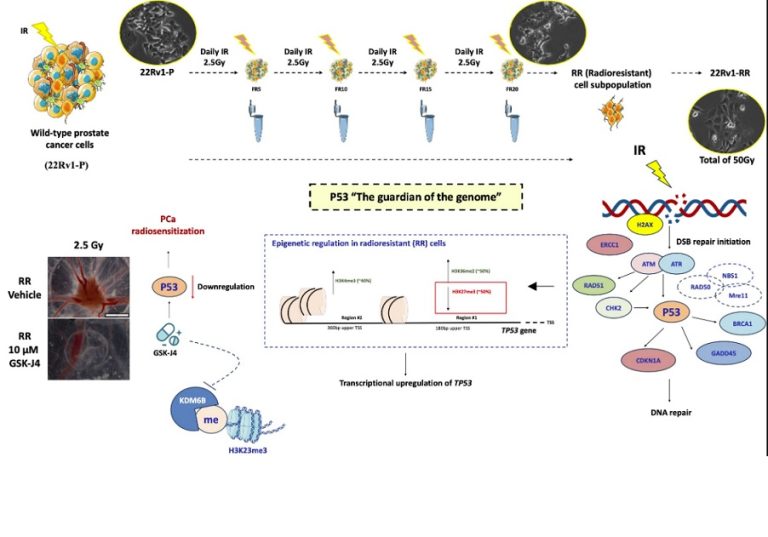 Study reveals the role of epigenetics in prostate cancer radioresistance