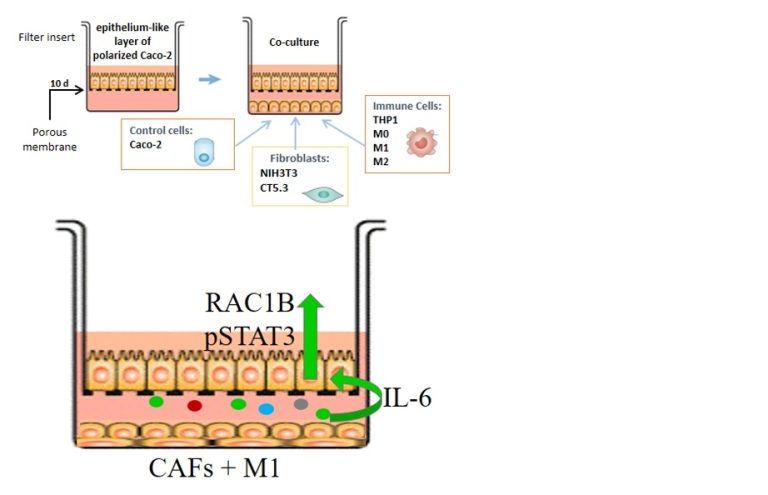Pro-inflammatory IL-6 triggers overexpression of splice variant RAC1B