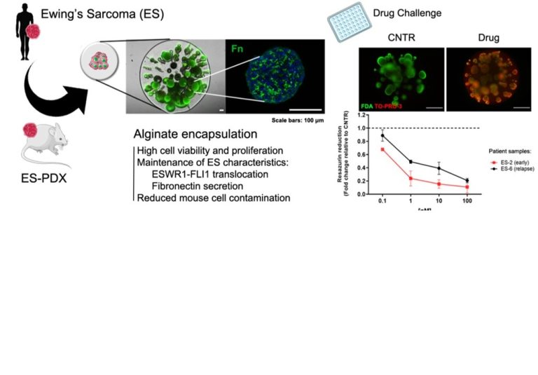 A novel in vitro Ewing’s Sarcoma 3D cell model